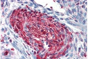 Human Uterus, Vessel (formalin-fixed, paraffin-embedded) stained with S100A4 antibody ABIN337109 at 2. (s100a4 anticorps  (AA 86-98))