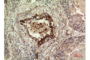 Immunohistochemistry (IHC) analysis of paraffin-embedded Human Lung, antibody was diluted at 1:100. (IDH1 anticorps  (N-Term))