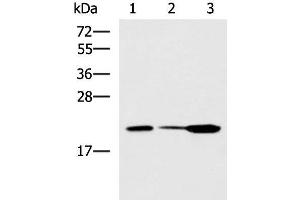 Western blot analysis of Mouse small intestines tissue Mouse kidney tissue Mouse pancreas tissue lysates using PPIC Polyclonal Antibody at dilution of 1:550
