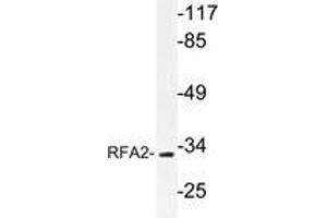 Western blot analysis of RFA2 antibody in extracts from HepG2 cells. (RPA2 anticorps  (AA 115-129))