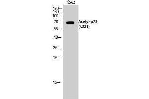 Western Blotting (WB) image for anti-Tumor Protein P73 (TP73) (acLys321) antibody (ABIN3181893)