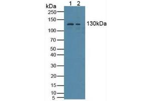 Figure. (NCOA3 anticorps  (AA 1023-1304))