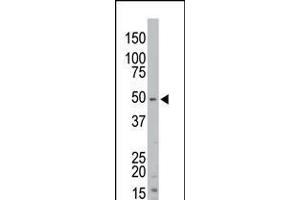Antibody is used in Western blot to detect STK35 in mouse kidney tissue lysate. (STK35 anticorps  (AA 374-404))