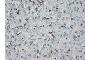 Immunohistochemical staining of paraffin-embedded Human liver tissue using anti-GIMAP4 mouse monoclonal antibody. (GIMAP4 anticorps)