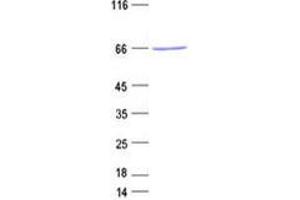 Validation with Western Blot