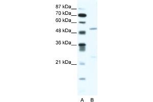WB Suggested Anti-BRD9 Antibody Titration:  2. (BRD9 anticorps  (N-Term))