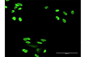 Immunofluorescence of purified MaxPab antibody to XRCC6 on HeLa cell. (XRCC6 anticorps  (AA 1-609))