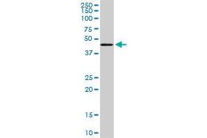 Western Blotting (WB) image for anti-Transcriptional Adaptor 2B (TADA2B) (AA 2-111) antibody (ABIN466261) (TADA2B anticorps  (AA 2-111))