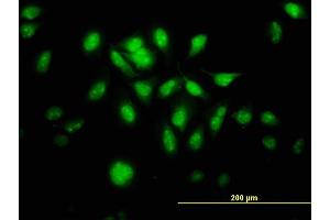 Immunofluorescence of monoclonal antibody to MTA1 on HeLa cell.