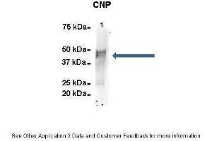 Amount and Sample Type :  500 ug mouse brain homogenate  Amount of IP Antibody :  6 ug  Primary Antibody :  CNP  Primary Antibody Dilution :  1:500  Secondary Antibody :  Goat anti-rabbit Alexa-Fluor 594  Secondary Antibody Dilution :  1:5000  Gene Name :  CNP  Submitted by :  Dr.