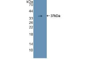Western blot analysis of recombinant Human EGFR2. (EGFR anticorps  (AA 713-984))