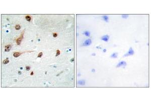Immunohistochemistry analysis of paraffin-embedded human brain tissue, using ADAR1 antibody. (ADAR anticorps  (C-Term))