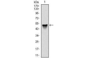 Western blot analysis using SRC mAb against human SRC (AA: 1-189) recombinant protein. (Src anticorps)