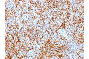 Formalin-fixed, paraffin-embedded human Spleen stained with CD61 Rabbit Recombinant Monoclonal Antibody (ITGB3/2166R).