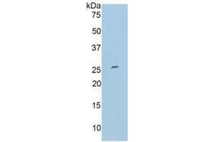 WB of Protein Standard: different control antibodies against Highly purified E. (MMP11 Kit ELISA)
