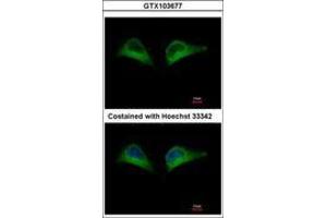 Image no. 2 for anti-Proteasome (Prosome, Macropain) 26S Subunit, Non-ATPase, 7 (PSMD7) (AA 47-324) antibody (ABIN1500489)