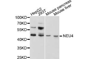 Western blot analysis of extracts of various cell lines, using NEU4 antibody (ABIN1876358) at 1:1000 dilution.