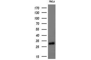 Western Blotting (WB) image for anti-Adiponectin (ADIPOQ) (AA 19-244) antibody (ABIN2715778) (ADIPOQ anticorps  (AA 19-244))