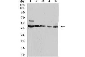 Western blot analysis using IDH1 mouse mAb against HepG2 (1), NIH/3T3 (2), C2C12 (3), COS7 (4), and SW480 (5) cell lysate. (IDH1 anticorps  (AA 156-298))