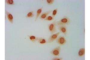 Immunocytochemistry analysis of ABIN7139600 diluted at 1:5 and staining in Hela cells performed on a Leica BondTM system.