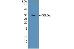 Detection of Recombinant ITGa2, Human using Polyclonal Antibody to Integrin Alpha 2 (ITGa2) (ITGA2 anticorps  (AA 74-277))