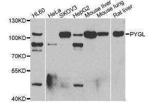 Western blot analysis of extracts of various cell lines, using PYGL antibody. (PYGL anticorps)