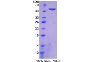 SDS-PAGE analysis of Human Interferon alpha 21 Protein.