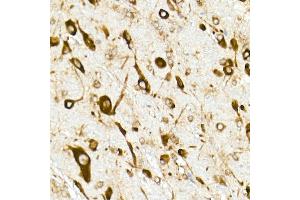 Immunohistochemistry of paraffin-embedded rat brain using RPL10A Rabbit mAb (ABIN7269992) at dilution of 1:25 (40x lens). (RPL10A anticorps)