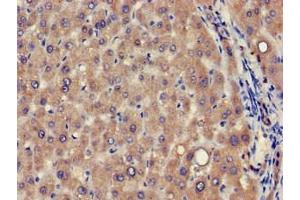 Immunohistochemistry of paraffin-embedded human liver tissue using ABIN7175353 at dilution of 1:100 (VPS39 anticorps  (AA 263-490))