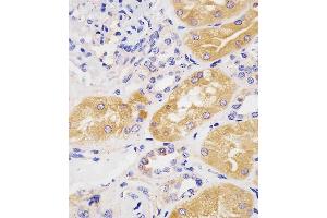 (ABIN1944892 and ABIN2838534) staining H in human kidney tissue sections by Immunohistochemistry (IHC-P - raformaldehyde-fixed, raffin-embedded sections).