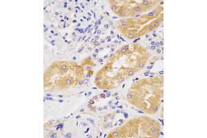 (ABIN1944892 and ABIN2838534) staining H in human kidney tissue sections by Immunohistochemistry (IHC-P - raformaldehyde-fixed, raffin-embedded sections). (Phenylalanine Hydroxylase anticorps  (AA 127-161))
