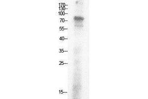 Western Blot (WB) analysis of HepG2 cells using Acetyl-Ub (K29) Polyclonal Antibody.