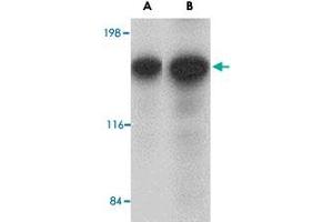 Western blot analysis of CADPS in rat brain tissue lysate with CADPS polyclonal antibody  at (A) 0. (CADPS anticorps  (N-Term))