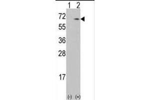 Western blot analysis of CKK1 (arrow) using rabbit polyclonal CKK1 Antibody (N-term) (ABIN392189 and ABIN2841895). (CAMKK1 anticorps  (N-Term))