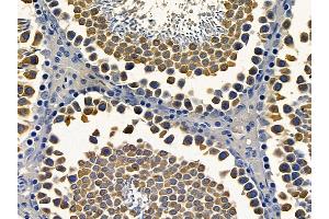 ABIN6264551 and ABIN6272407 at 1/100 staining rat testis tissue by IHC-P.