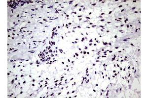 Image no. 17 for anti-Nibrin (NBN) (AA 183-460) antibody (ABIN1491066)