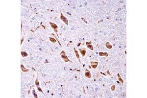 PAK3 antibody immunohistochemistry analysis in formalin fixed and paraffin embedded mouse brain tissue.