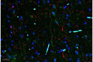 Image no. 3 for anti-Interleukin 11 (IL11) antibody (ABIN465144) (IL-11 anticorps)