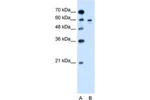 Western Blotting (WB) image for anti-Tyrosinase (TYR) antibody (ABIN2462800) (TYR anticorps)