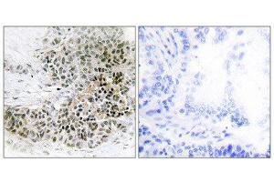 Immunohistochemistry (IHC) image for anti-Trichorhinophalangeal Syndrome I (TRPS1) (N-Term) antibody (ABIN1850056) (TRPS1 anticorps  (N-Term))
