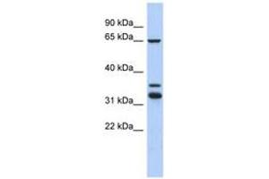 Image no. 1 for anti-S100P Binding Protein (S100PBP) (C-Term) antibody (ABIN6744009) (S100PBP anticorps  (C-Term))