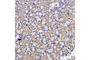 Immunohistochemistry of paraffin-embedded rat brain using SN Rabbit pAb (ABIN3021231, ABIN3021232, ABIN3021233 and ABIN6214078) at dilution of 1:100 (40x lens). (SNAP25 anticorps  (AA 1-206))
