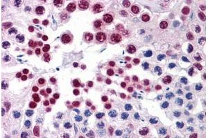 Human Testis: Formalin-Fixed, Paraffin-Embedded (FFPE)