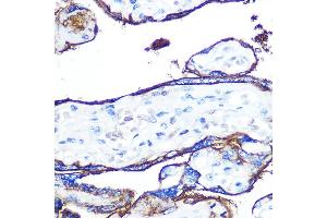 Immunohistochemistry of paraffin-embedded human placenta using CD55 Rabbit mAb (ABIN7266478) at dilution of 1:100 (40x lens).