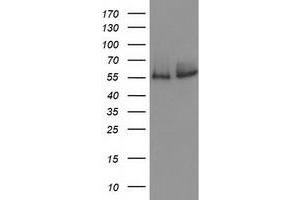 Western Blotting (WB) image for anti-Catalase (CAT) antibody (ABIN1497109) (Catalase anticorps)