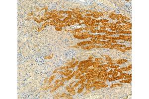 ABIN6260864 and ABIN6266508 at 1/100 staining Rat kidney tissue by IHC-P. (Claudin 2 anticorps  (C-Term))