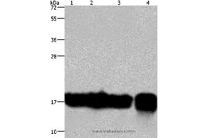 Western blot analysis of A549 and K562 cell, Raji cell and human fetal intestine tissue, using IL17C Polyclonal Antibody at dilution of 1:300 (IL17C anticorps)