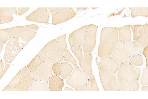 Detection of MYL3 in Human Skeletal muscle Tissue using Polyclonal Antibody to Myosin Light Chain 3, Alkali, Ventricular, Slow Skeletal (MYL3) (MYL3/CMLC1 anticorps  (AA 5-181))