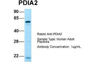 Host: Rabbit  Target Name: PDIA2  Sample Tissue: Human Adult Placenta  Antibody Dilution: 1. (PDIA2 anticorps  (N-Term))