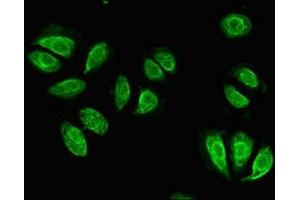 Immunofluorescent analysis of A549 cells using ABIN7156486 at dilution of 1:100 and Alexa Fluor 488-congugated AffiniPure Goat Anti-Rabbit IgG(H+L)